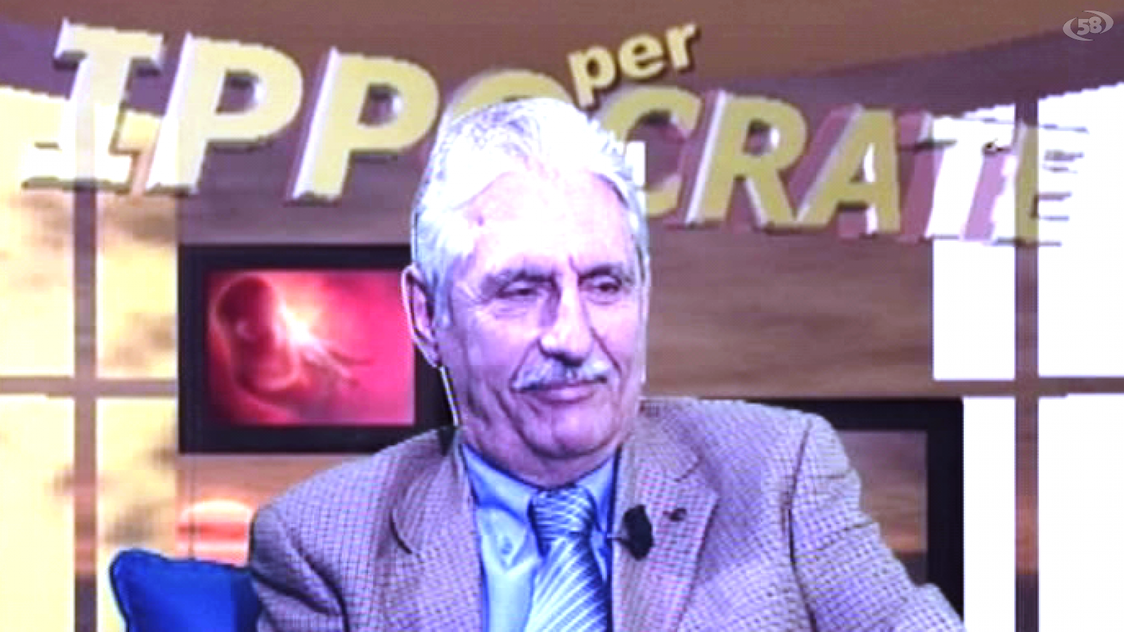 lombardi