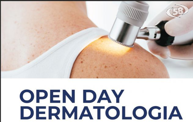 Open day in Dermatologia, parte al San Pio lo screening gratuito 